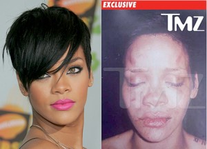 RIHANNA BEATING PHOTO